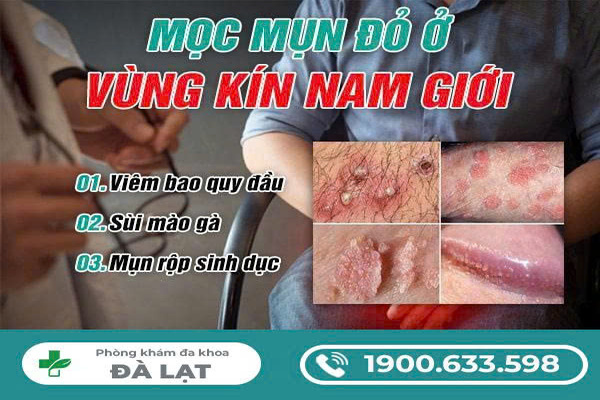 Hình ảnh minh họa